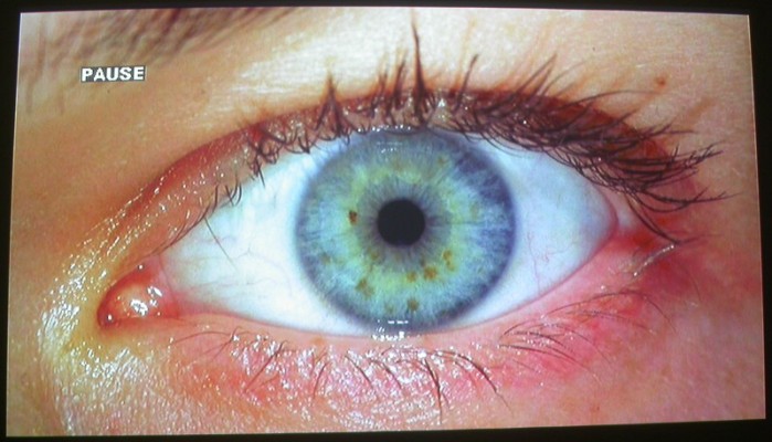 Postad bild